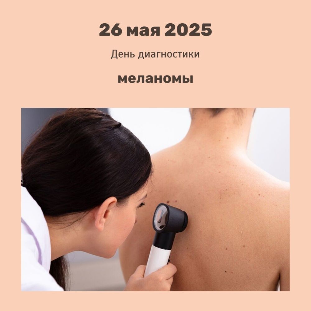 ДЕНЬ ДИАГНОСТИКИ МЕЛАНОМЫ